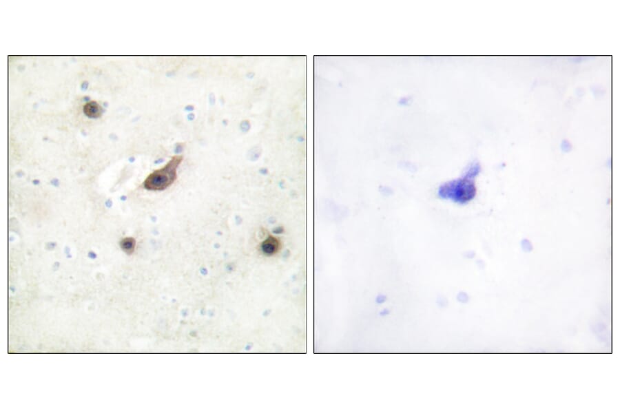 Immunohistochemistry - Anti-B-RAF Antibody (C10378) - Antibodies.com