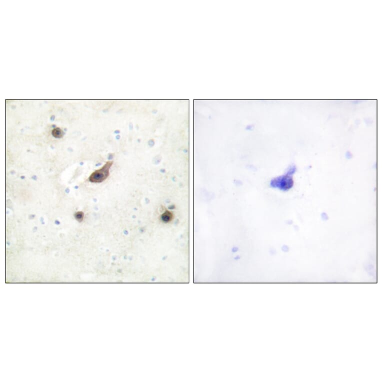 Immunohistochemistry - Anti-B-RAF Antibody (C10378) - Antibodies.com