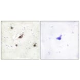 Immunohistochemistry - Anti-B-RAF Antibody (C10378) - Antibodies.com