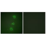 Immunofluorescence - Anti-B-RAF Antibody (C10378) - Antibodies.com