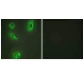 Immunofluorescence - Anti-BCKD Antibody (C10056) - Antibodies.com
