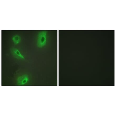 Immunofluorescence - Anti-BCKD Antibody (C10056) - Antibodies.com
