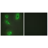 Immunofluorescence - Anti-BCKD Antibody (C10056) - Antibodies.com