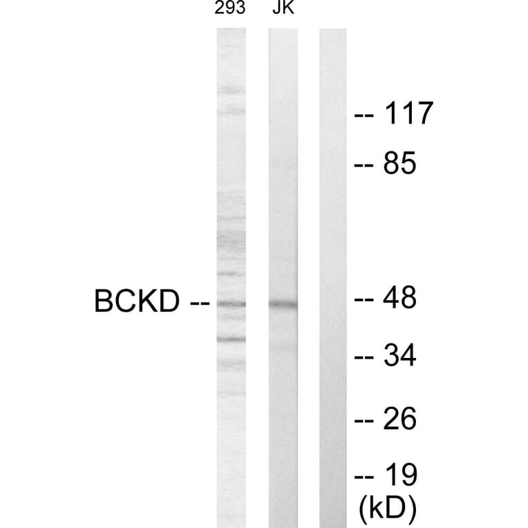 Western Blot - Anti-BCKD Antibody (C10056) - Antibodies.com