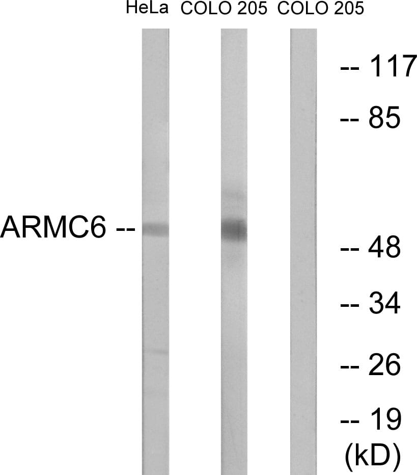 Western blot analysis of lysates from HeLa and COLO cells using Anti-ARMC6 Antibody. The right hand lane represents a negative control, where the antibody is blocked by the immunising peptide.
