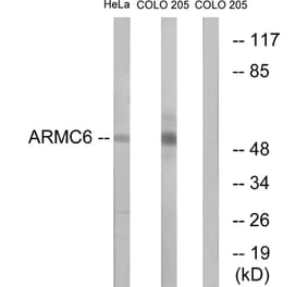 Western Blot - Anti-ARMC6 Antibody (C14562) - Antibodies.com
