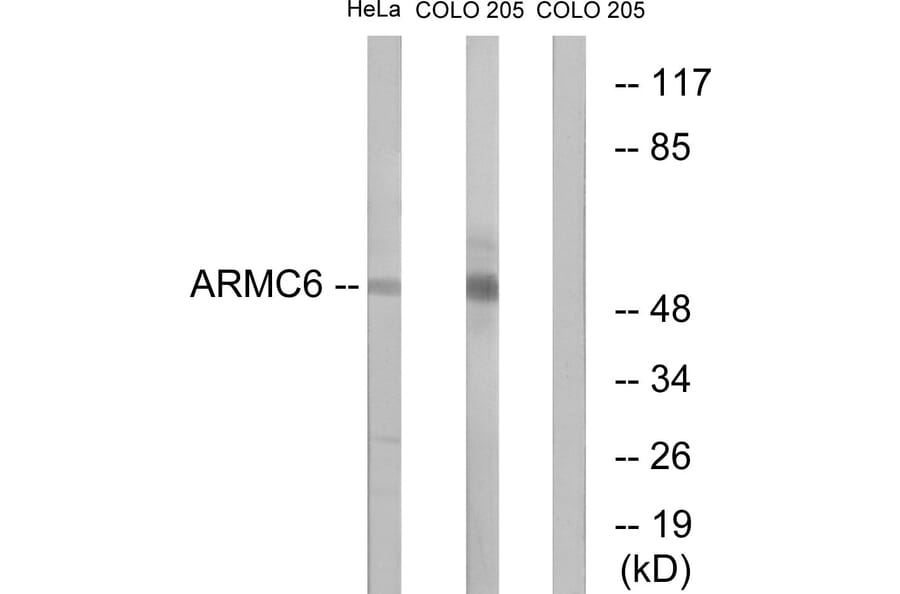 Western Blot - Anti-ARMC6 Antibody (C14562) - Antibodies.com