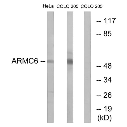 Western Blot - Anti-ARMC6 Antibody (C14562) - Antibodies.com