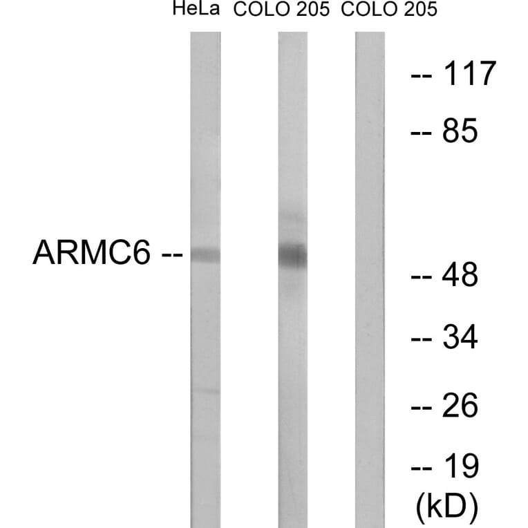 Western Blot - Anti-ARMC6 Antibody (C14562) - Antibodies.com