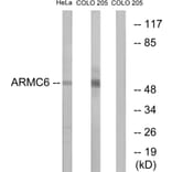 Western Blot - Anti-ARMC6 Antibody (C14562) - Antibodies.com