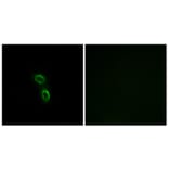 Immunofluorescence - Anti-ARMC6 Antibody (C14562) - Antibodies.com