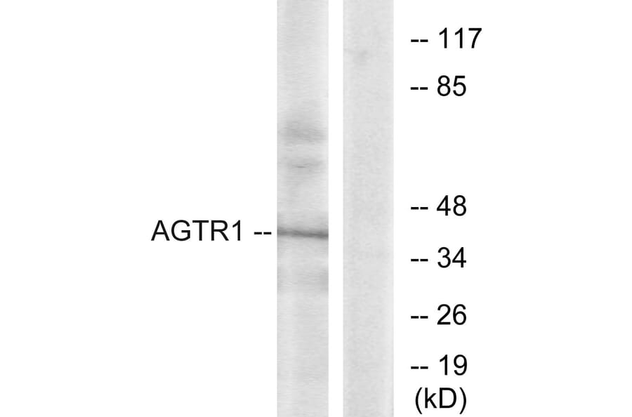Western Blot - Anti-AGTR1 Antibody (G212) - Antibodies.com