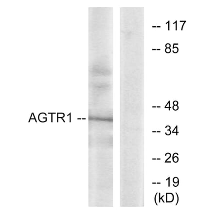 Western Blot - Anti-AGTR1 Antibody (G212) - Antibodies.com