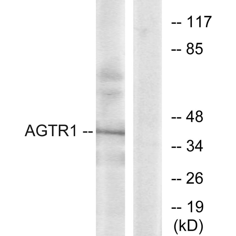 Western Blot - Anti-AGTR1 Antibody (G212) - Antibodies.com
