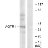 Western Blot - Anti-AGTR1 Antibody (G212) - Antibodies.com