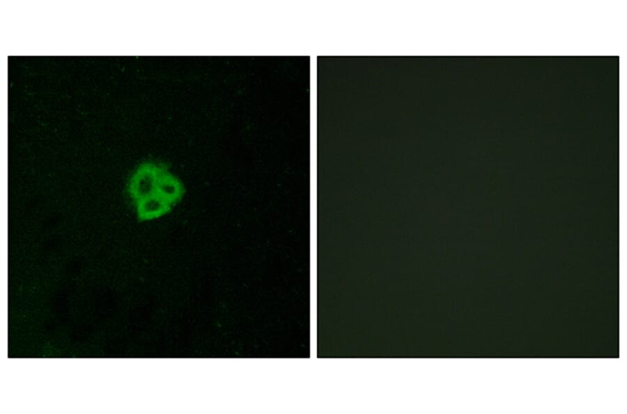 Immunofluorescence - Anti-AGTR1 Antibody (G212) - Antibodies.com