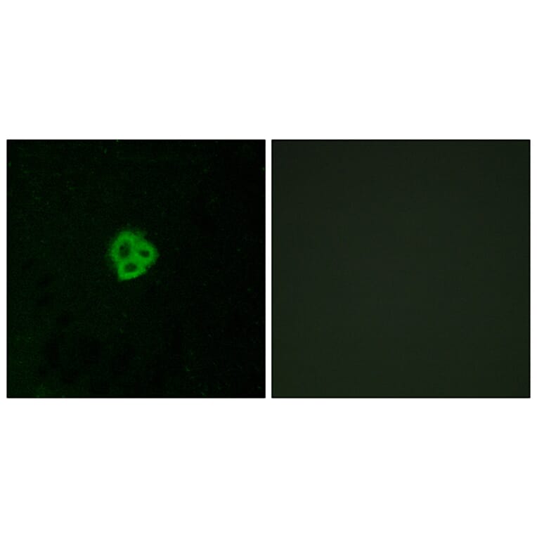 Immunofluorescence - Anti-AGTR1 Antibody (G212) - Antibodies.com