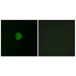 Immunofluorescence - Anti-AGTR1 Antibody (G212) - Antibodies.com