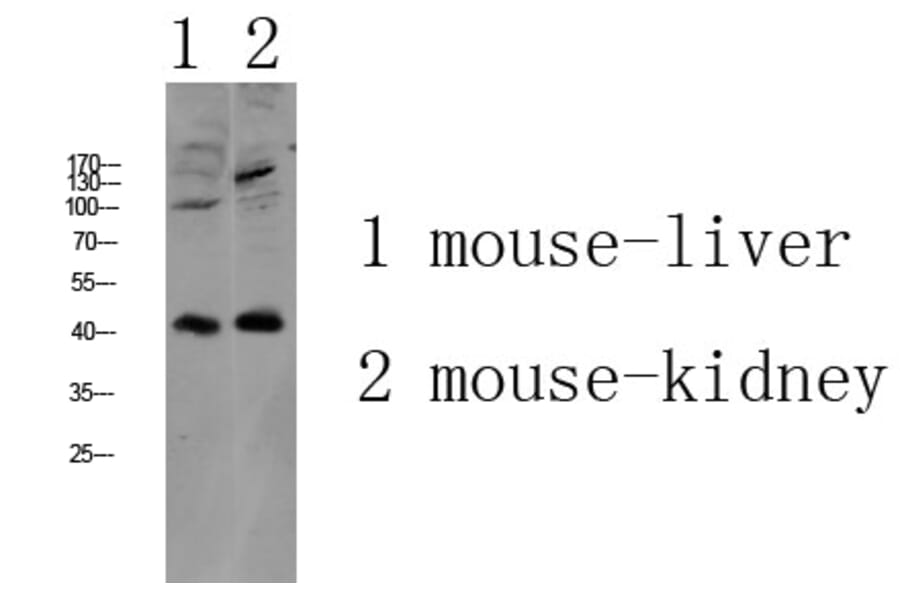 Western Blot - Anti-AGTR1 Antibody (G212) - Antibodies.com