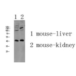 Western Blot - Anti-AGTR1 Antibody (G212) - Antibodies.com