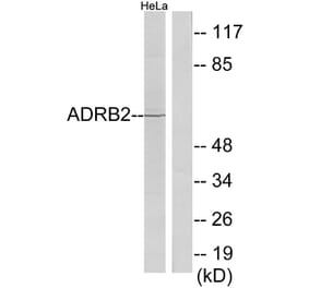 Western Blot - Anti-ADRB2 Antibody (C12044) - Antibodies.com