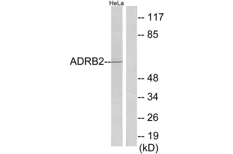 Western Blot - Anti-ADRB2 Antibody (C12044) - Antibodies.com