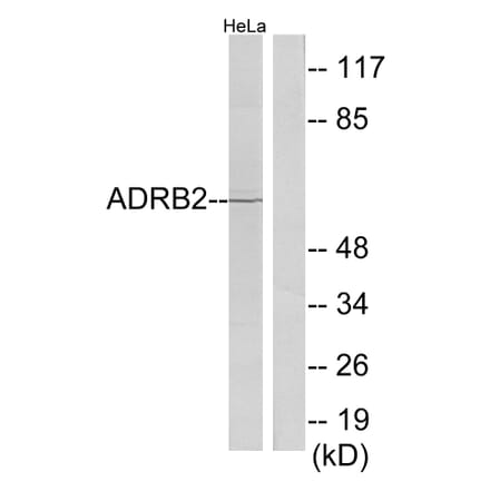 Western Blot - Anti-ADRB2 Antibody (C12044) - Antibodies.com