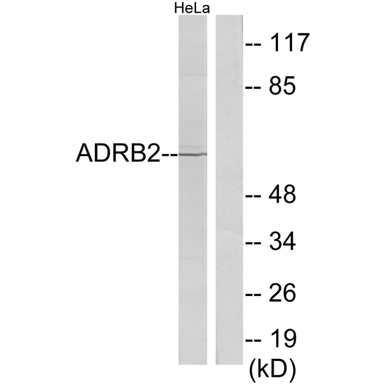 Western Blot - Anti-ADRB2 Antibody (C12044) - Antibodies.com