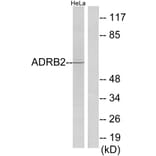 Western Blot - Anti-ADRB2 Antibody (C12044) - Antibodies.com