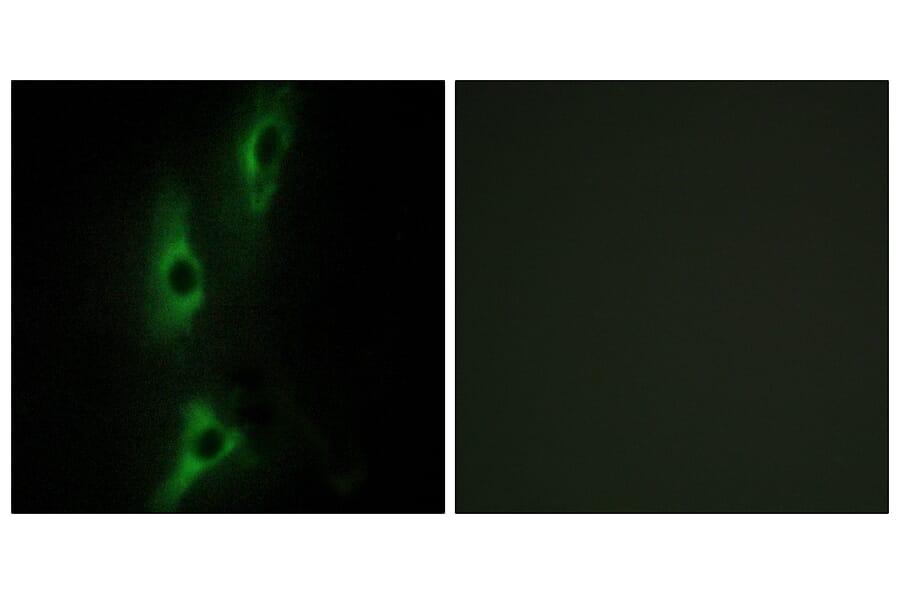 Immunofluorescence - Anti-ADRB2 Antibody (C12044) - Antibodies.com