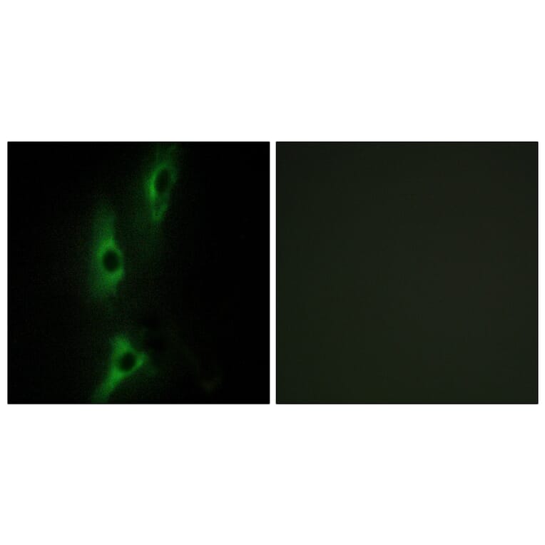 Immunofluorescence - Anti-ADRB2 Antibody (C12044) - Antibodies.com