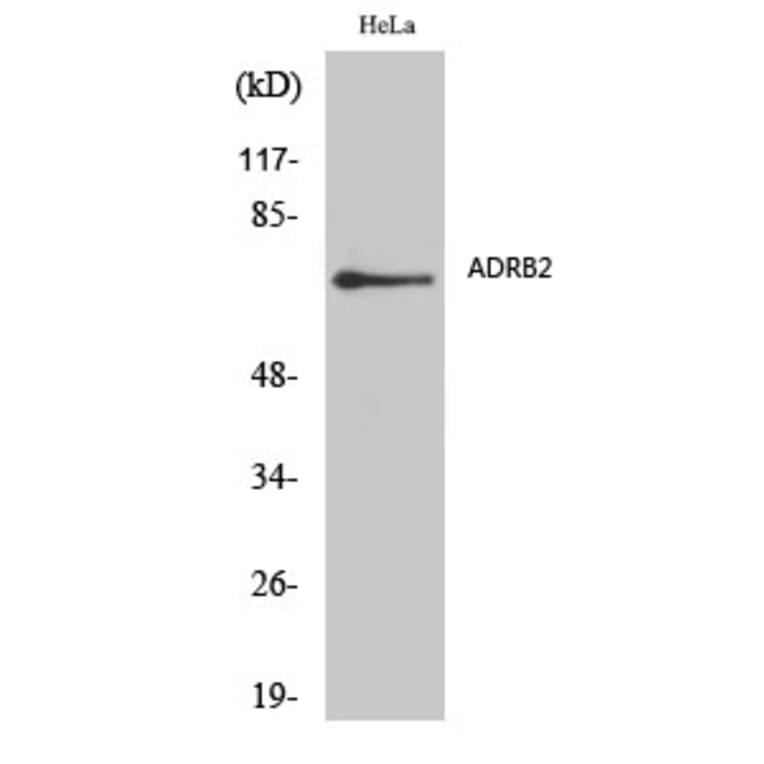 Western Blot - Anti-ADRB2 Antibody (C12044) - Antibodies.com