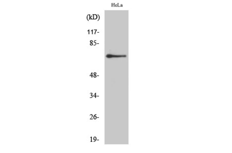 Western Blot - Anti-ADRB2 Antibody (C12044) - Antibodies.com