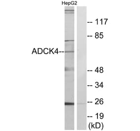 Western Blot - Anti-ADCK4 Antibody (C11484) - Antibodies.com