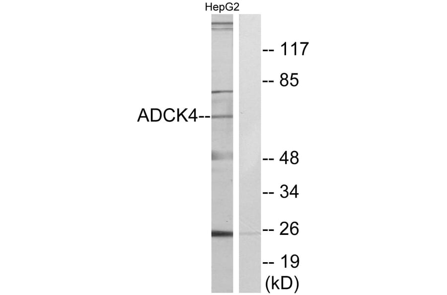 Western Blot - Anti-ADCK4 Antibody (C11484) - Antibodies.com