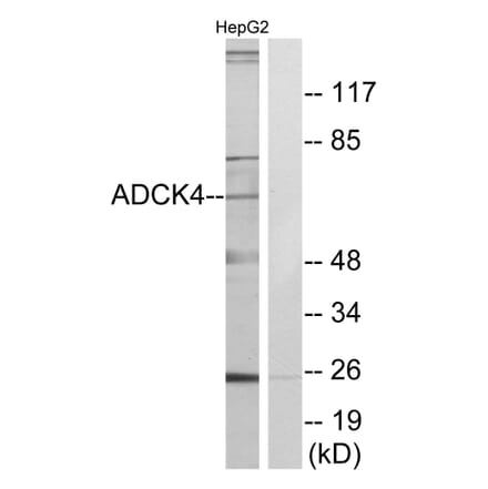 Western Blot - Anti-ADCK4 Antibody (C11484) - Antibodies.com