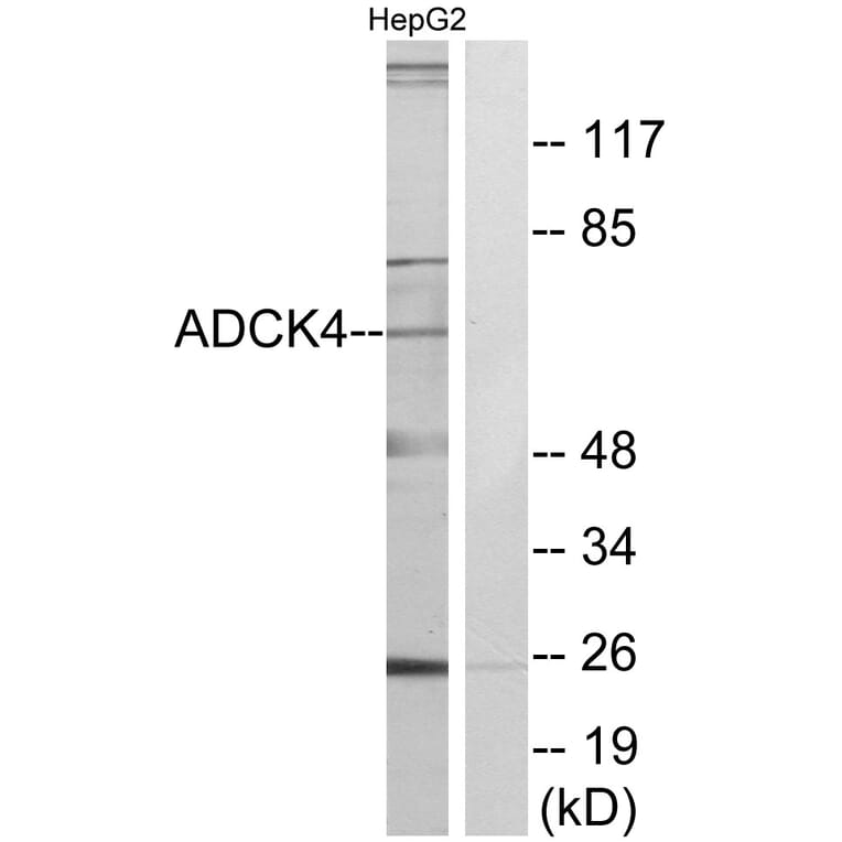 Western Blot - Anti-ADCK4 Antibody (C11484) - Antibodies.com