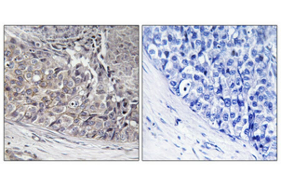 Immunohistochemistry - Anti-ADCK4 Antibody (C11484) - Antibodies.com