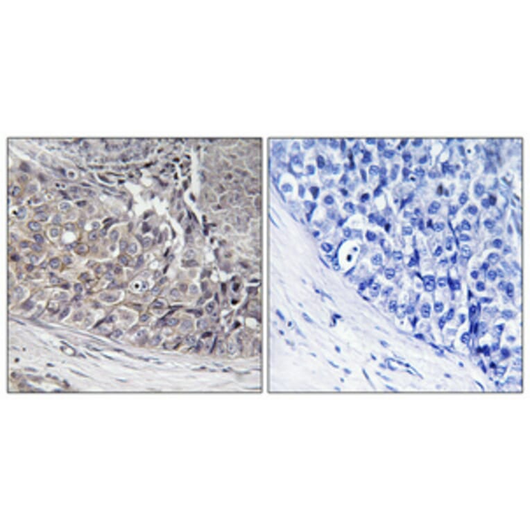 Immunohistochemistry - Anti-ADCK4 Antibody (C11484) - Antibodies.com