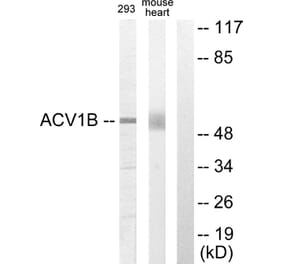 Western Blot - Anti-ACV1B Antibody (C10576) - Antibodies.com