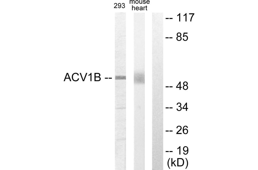 Western Blot - Anti-ACV1B Antibody (C10576) - Antibodies.com