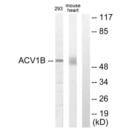 Western Blot - Anti-ACV1B Antibody (C10576) - Antibodies.com