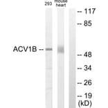 Western Blot - Anti-ACV1B Antibody (C10576) - Antibodies.com