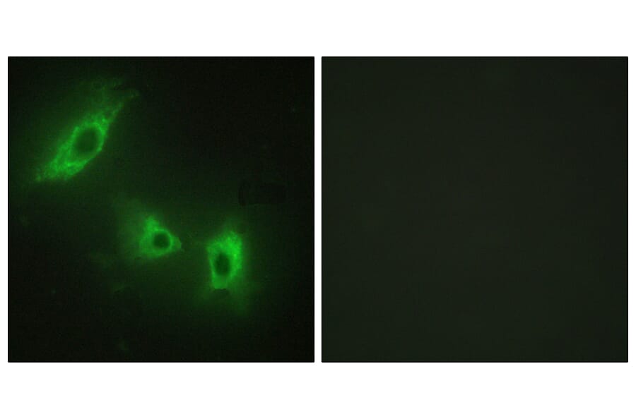 Immunofluorescence - Anti-ACV1B Antibody (C10576) - Antibodies.com