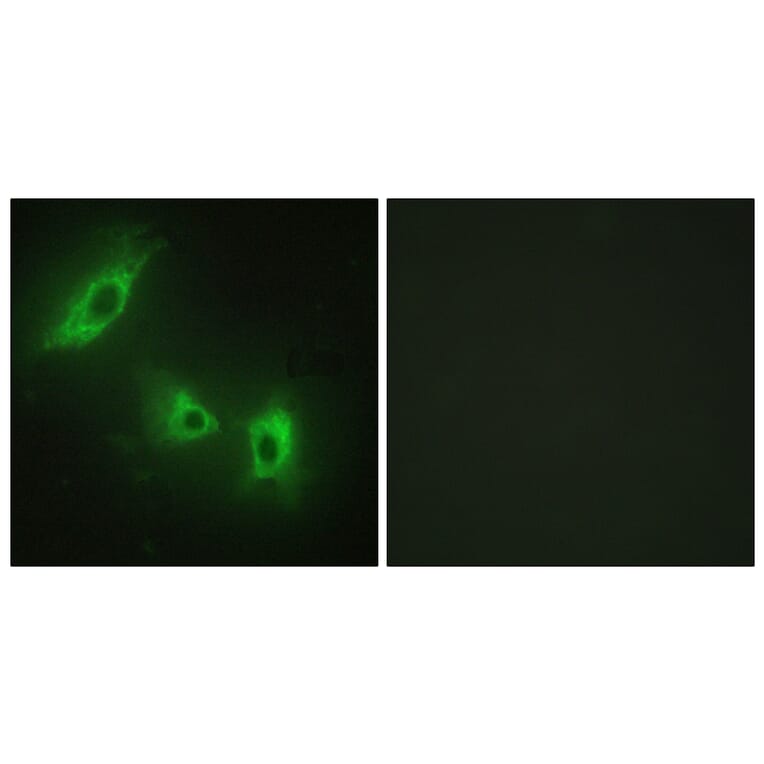 Immunofluorescence - Anti-ACV1B Antibody (C10576) - Antibodies.com