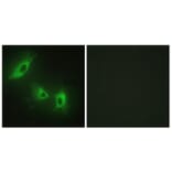 Immunofluorescence - Anti-ACV1B Antibody (C10576) - Antibodies.com