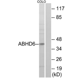 Western Blot - Anti-ABHD6 Antibody (C14218) - Antibodies.com