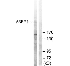 Western Blot - Anti-53BP1 Antibody (B0760) - Antibodies.com