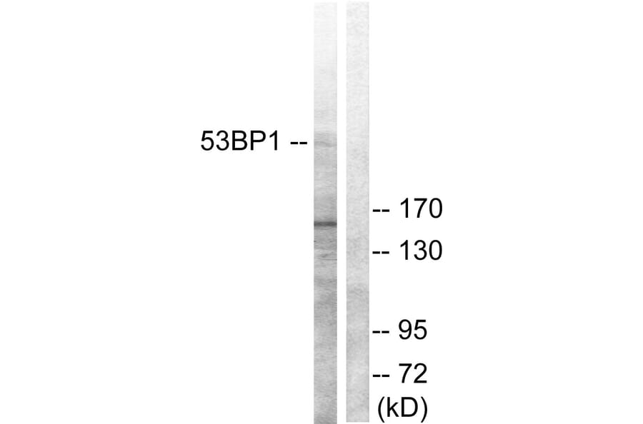Western Blot - Anti-53BP1 Antibody (B0760) - Antibodies.com
