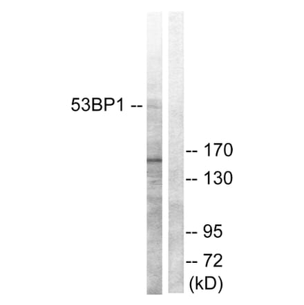 Western Blot - Anti-53BP1 Antibody (B0760) - Antibodies.com